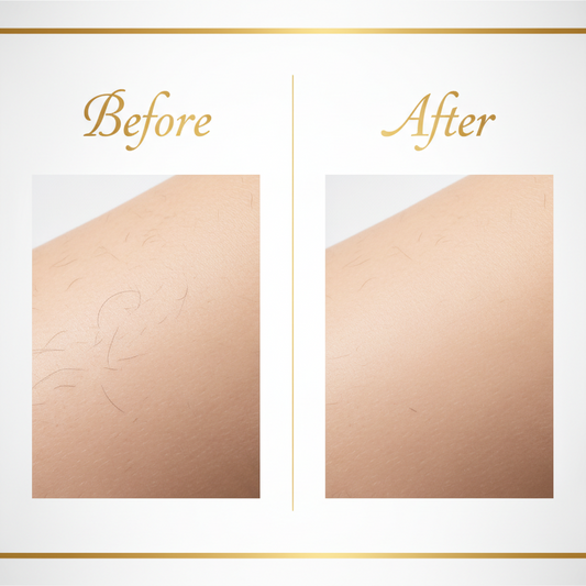 Épilateur IPL Professionnel & Rajeunissement Cutané - LumiSkin™